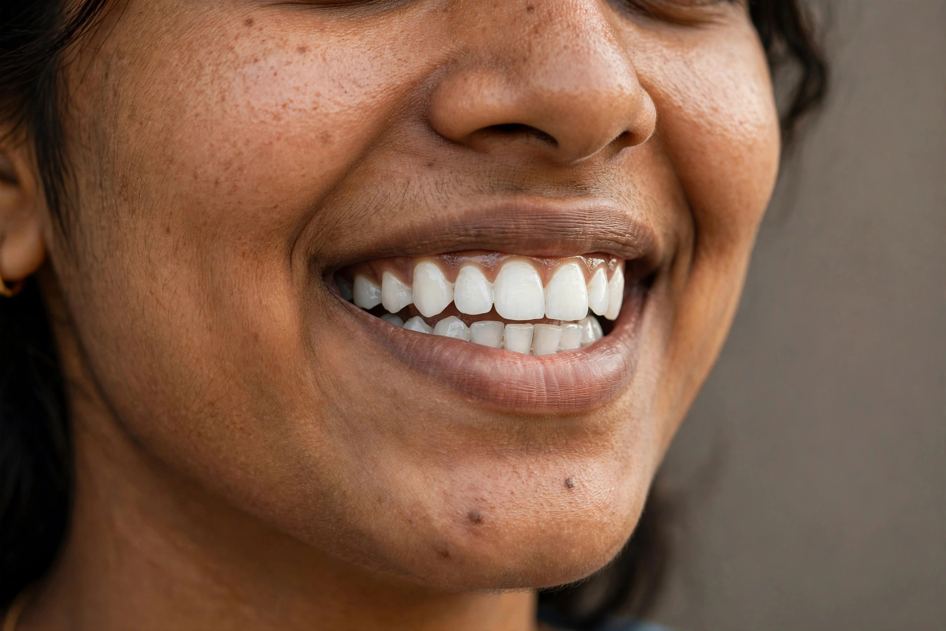 Smile after makeover