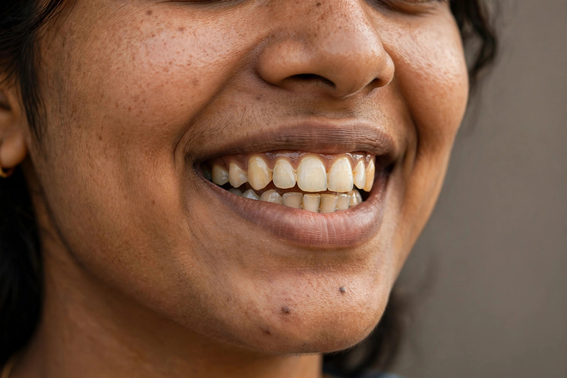 Smile before makeover